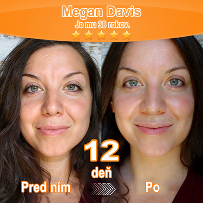 🇸🇰Purelora® Revitalizačný esenciálny krém s kmeňovými💧 bunkovými extraktmi, EGF a meďnatými peptidmi