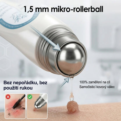 Oficiálny obchod značky |🔥Purelora® 7-dňový odstraňovač kožných výrastkov a škvŕn (bez bolesti, bez jaziev – rollerball aplikátor)🌈