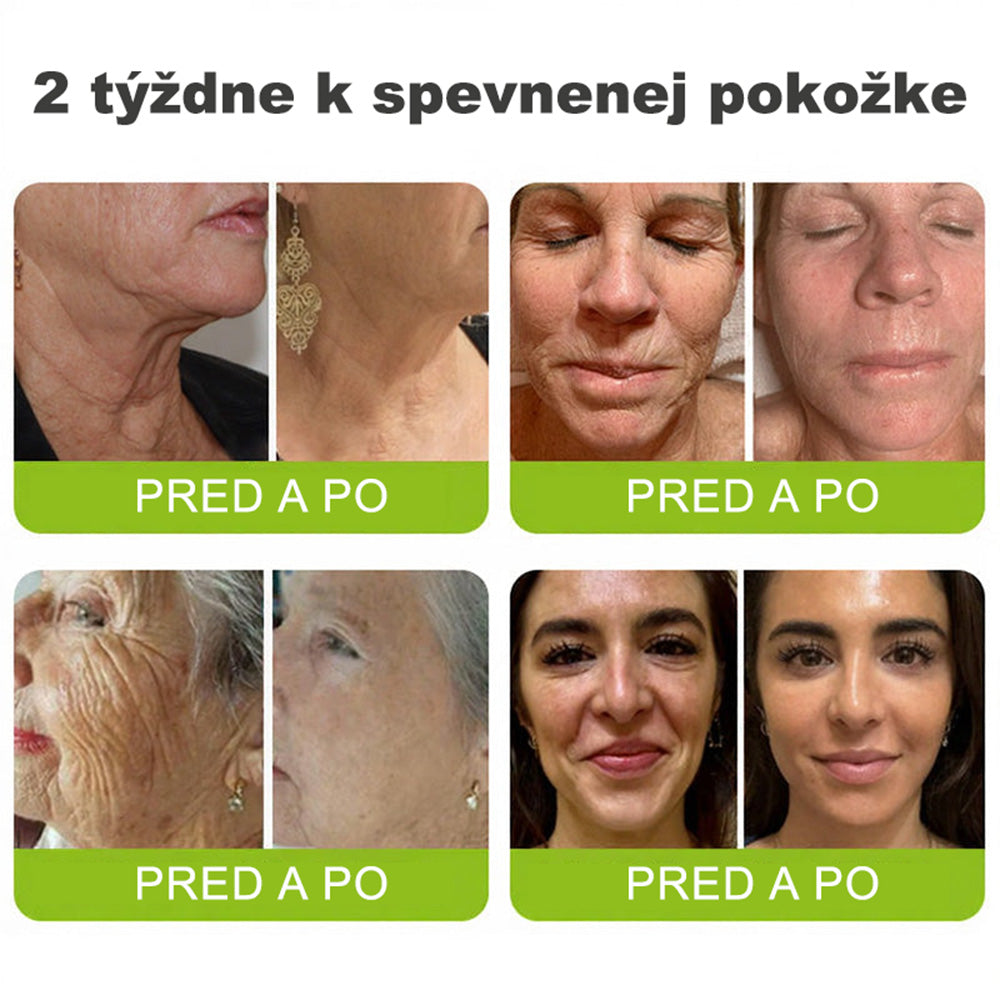🇸🇰Purelora® Skin Tightening & Vita-A Retinol Retinol🍀 shot Spevňujúci krém proti vráskam - Posledná akcia so 70% zľavou