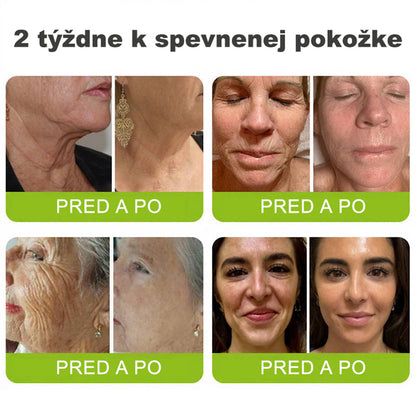 🇸🇰Purelora® Skin Tightening & Vita-A Retinol Retinol🍀 shot Spevňujúci krém proti vráskam - Posledná akcia so 70% zľavou