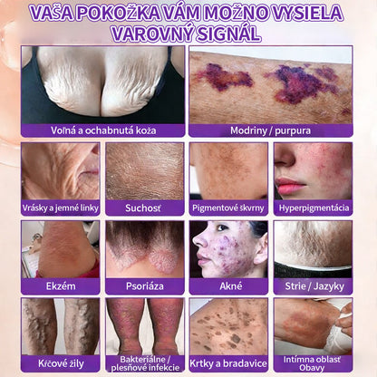 🇸🇰Vyrobené a dodané zo Slovenska ❤ Purelora® Biotínový 10-v-1 krém na obnovu pleti