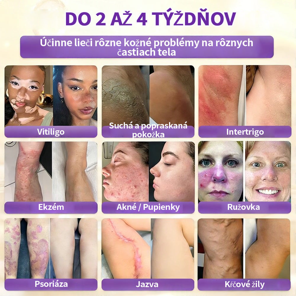 🇸🇰Vyrobené a dodané zo Slovenska ❤ Purelora® Biotínový 10-v-1 krém na obnovu pleti